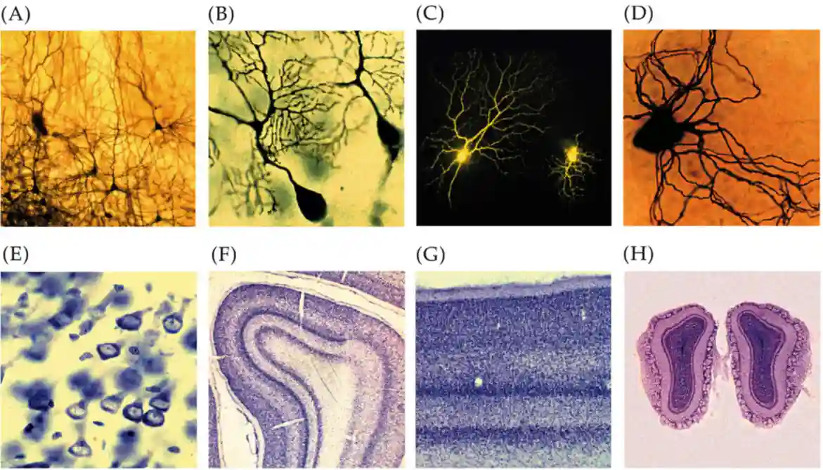 The Neuron-20250820195701874
